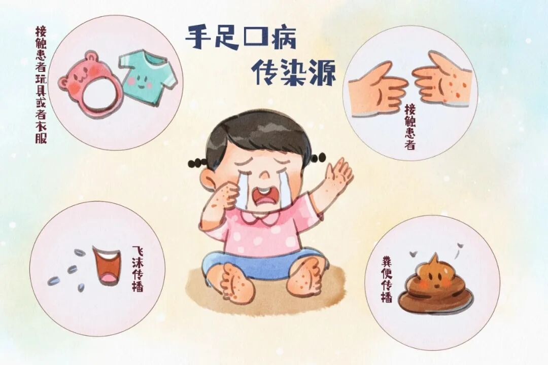 手足口病传染源.jpg
